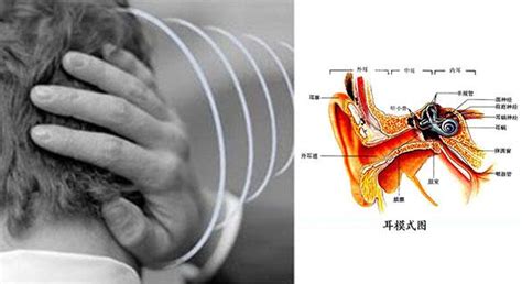 挖完耳朵耳鳴|耳朵嗡嗡叫，持續耳鳴怎麼辦？一文看懂「耳鳴」的8。